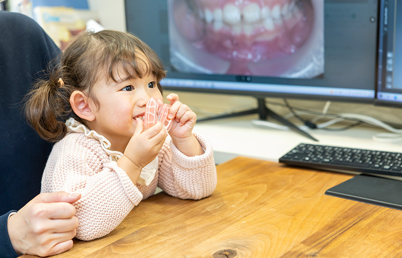 受け口が早期相談を推奨される理由